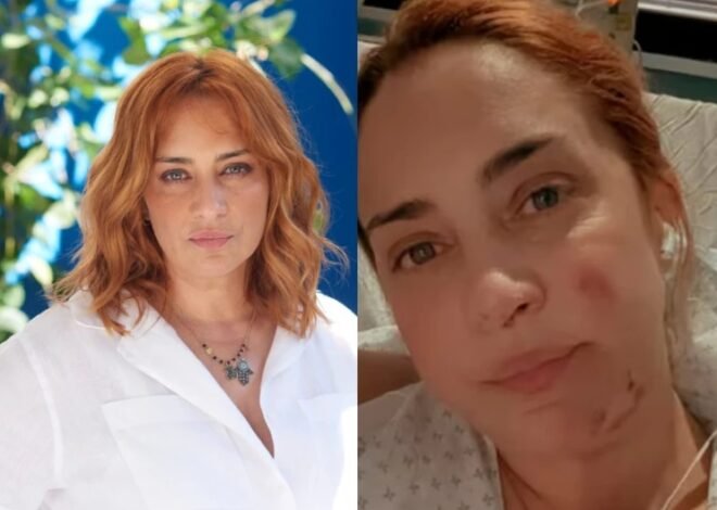 María Julia Oliván mostró las cicatrices que le dejaron las quemaduras que sufrió: video