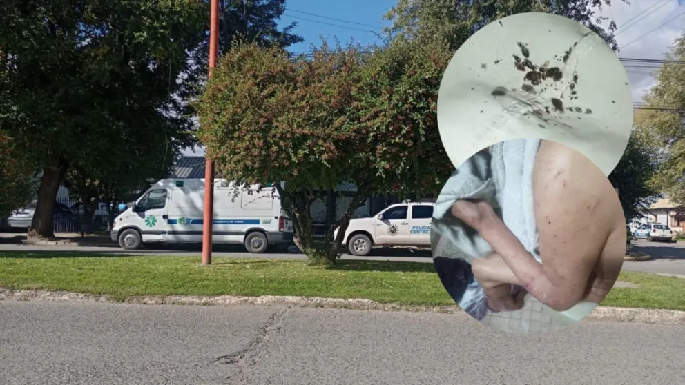 Piden clausurar un hogar de ancianos en Trevelin por graves condiciones sanitarias