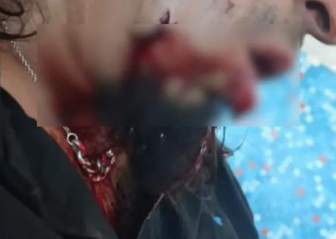 Qué se sabe del hombre baleado en el rostro en Máximo Abásolo