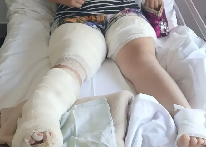 Su hija se quemó con agua caliente y necesitan una silla de ruedas para su traslado