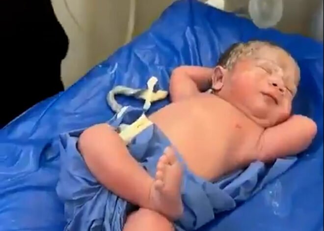 Un recién nacido se vuelve viral por su extremo relax: posó con las manos en la nuca a minutos de nacer